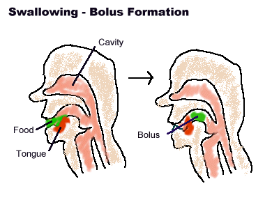 Bolus meaning